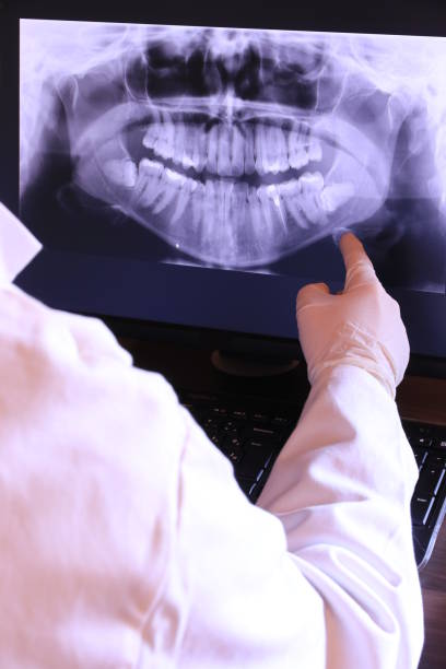 Best Teeth Whitening  in Valley City, ND