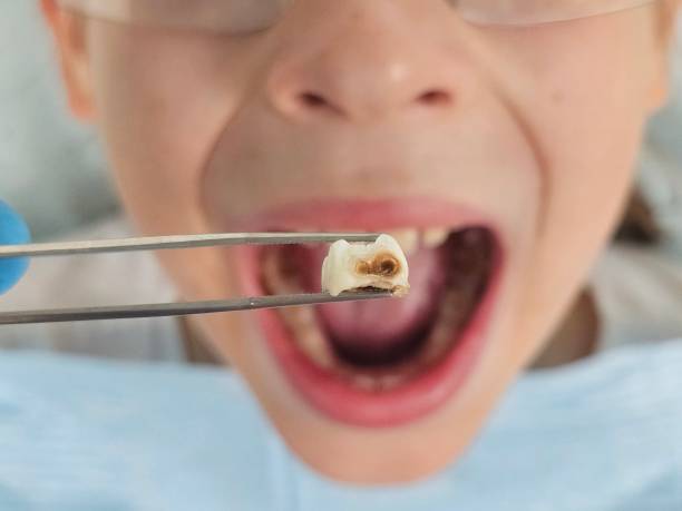 Best Dentist Open Late Near Me  in Valley City, ND